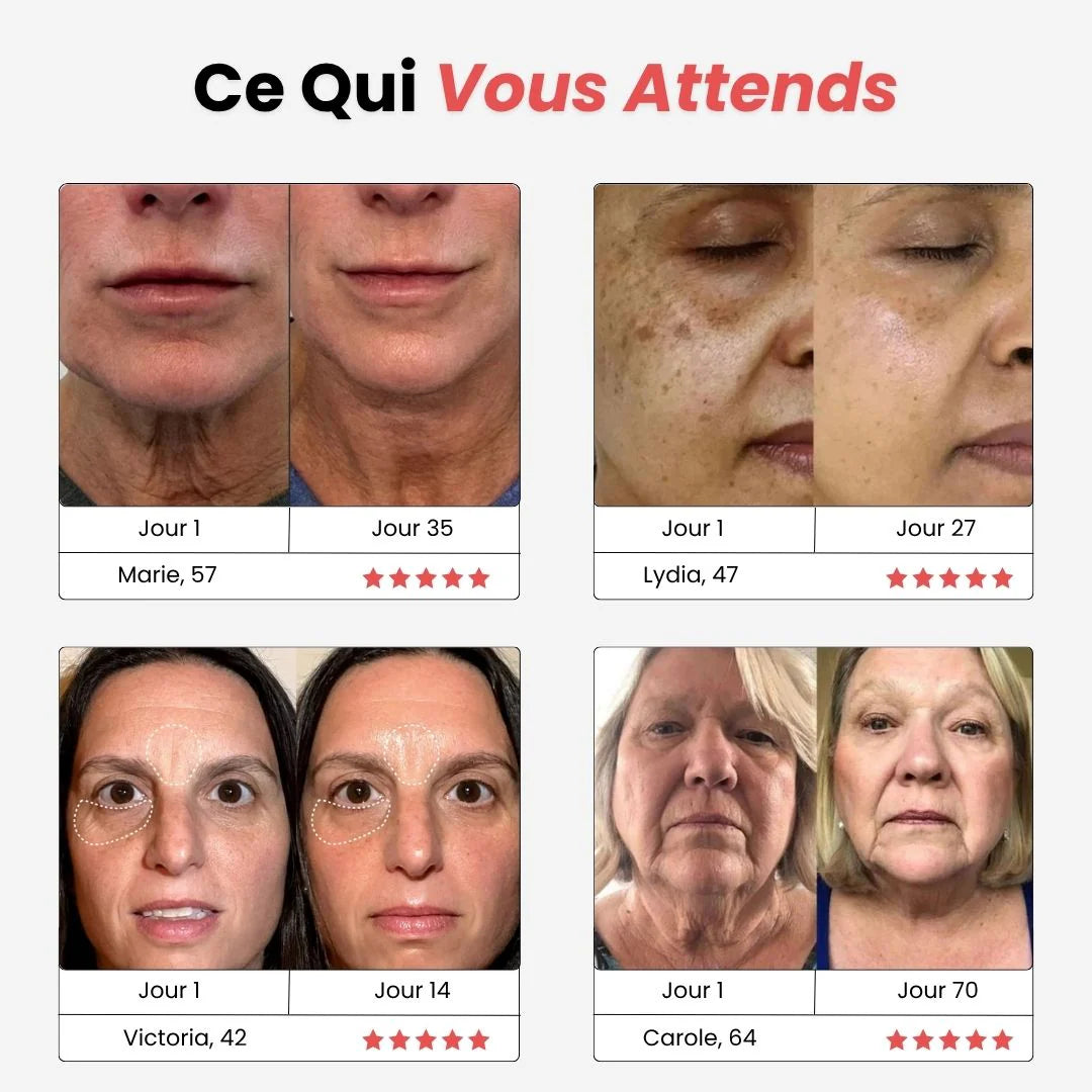 Néolift - Solena™