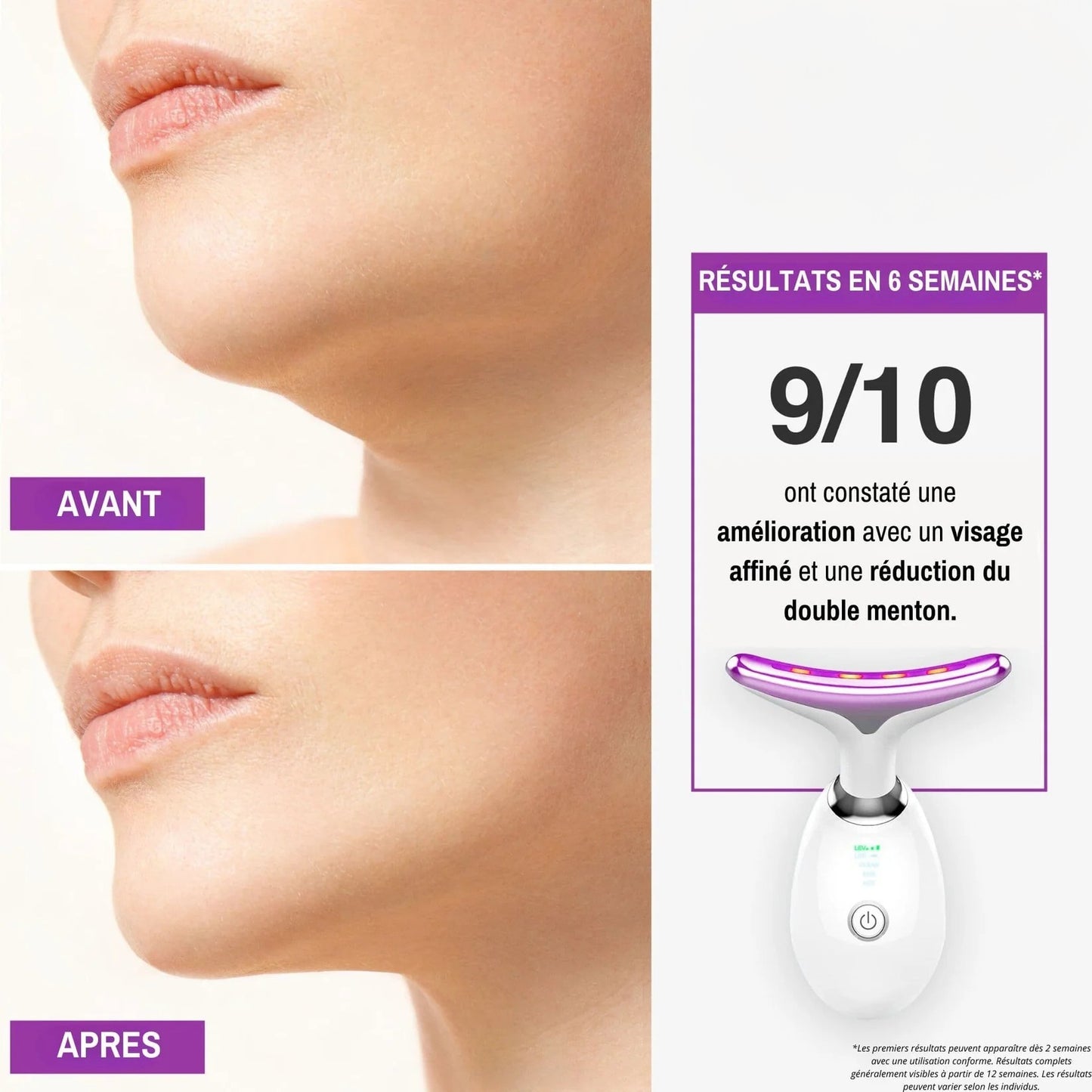 Néolift - Solena™