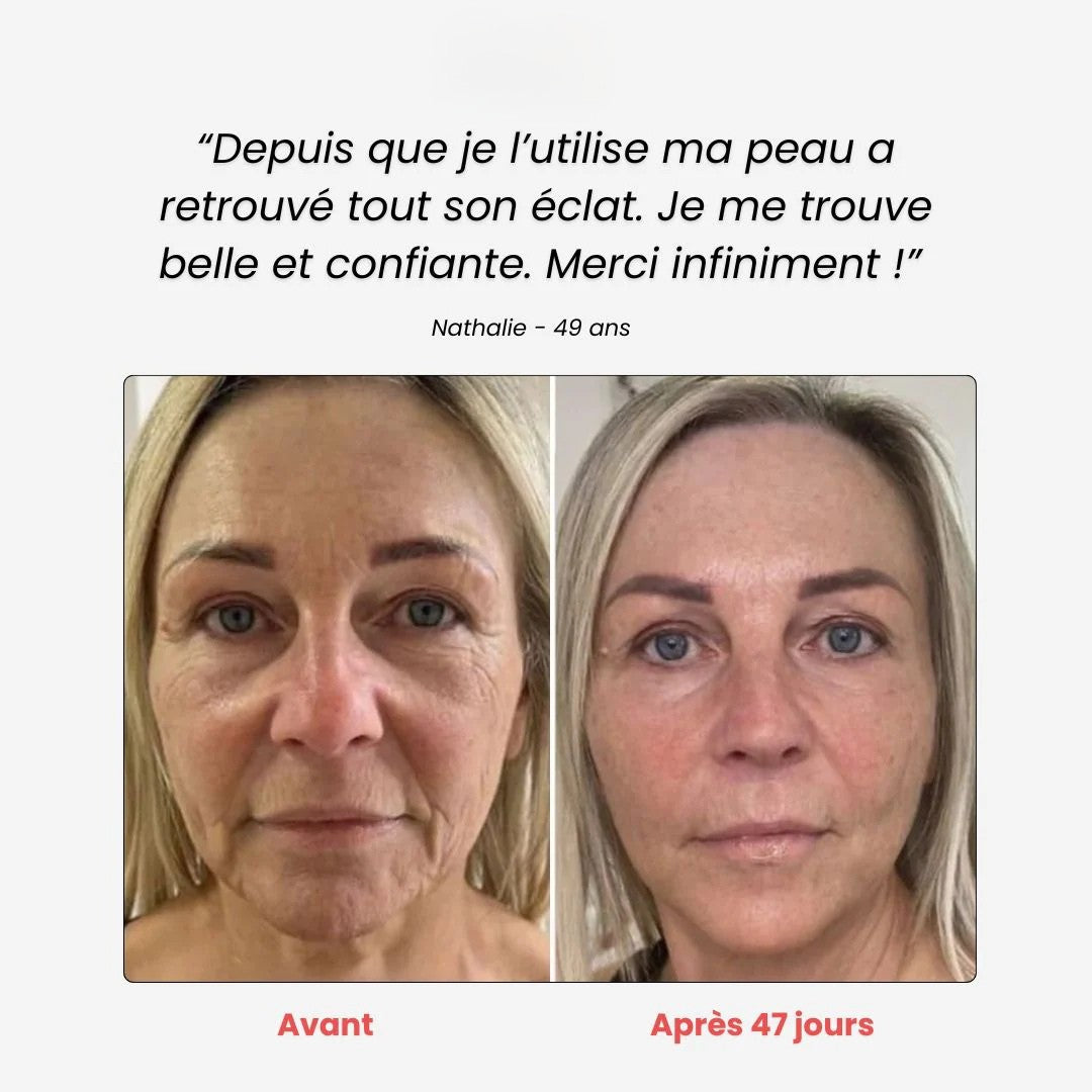 Néolift - Solena™