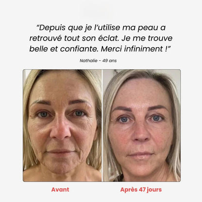 Néolift - Solena™